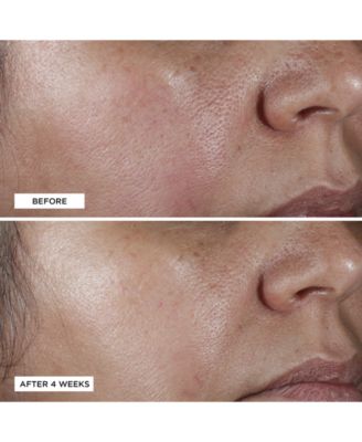 No:Rinse Intensive Pore Minimizing Toner, 4 fl. oz.