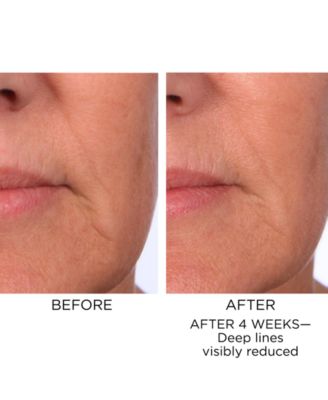 4-Pc. Prevage Progressive Renewal Treatment Set