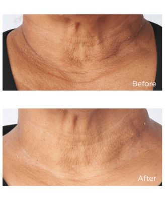 4-Pc. Cold Plasma Plus+ Power Set