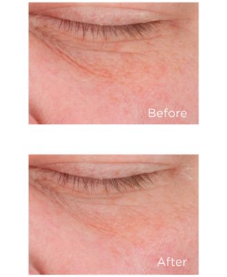 Cold Plasma Plus+ Eye Advanced Eye Cream, 0.5-oz.