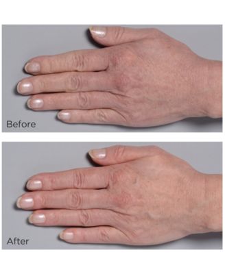 Cold Plasma Plus+ Hand Therapy, 2-oz.