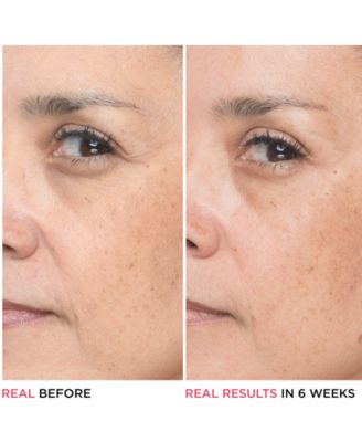 Bye Bye Lines 1.5% Hyaluronic Acid Concentrated Derma Serum