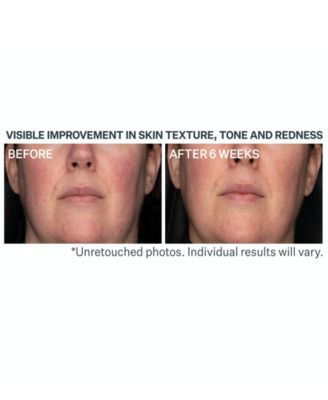 Advanced Retinol Daily Repair Moisturizer SPF 30