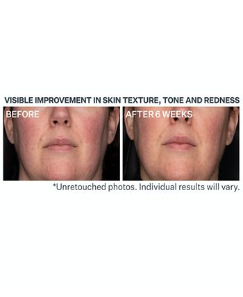StriVectin - Advanced Retinol Daily Repair Moisturizer SPF 30
