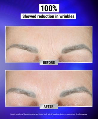 Retinol Fast Release Wrinkle-Reducing Night Serum, 0.94 oz.