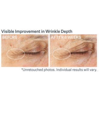 Advanced Retinol Multi-Correct Eye Cream