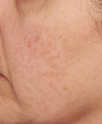 Vitamin C Ester Intensive Dark Spot Treatment, 1 oz. 