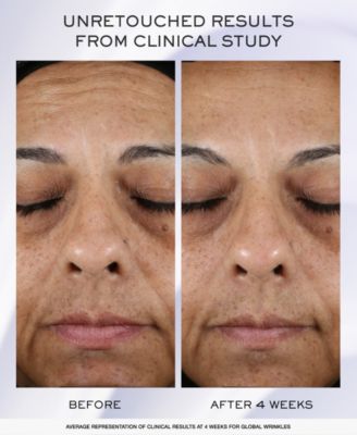 Lancôme 3-Pc. Rénergie H.C.F. Triple Serum Holiday Set