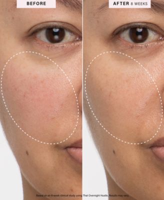 That Overnight Hustle AHA + BHA Resurfacer