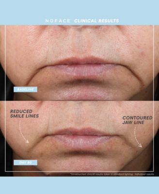 6-Pc. Trinity+ Complete Toning Set