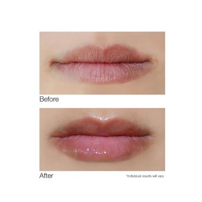 SMOOTH LIP Volumizer
