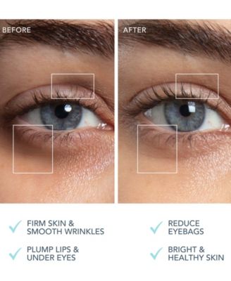 SUPERCHARGED Eye & Lip Contour Booster 3.5 ml x 3