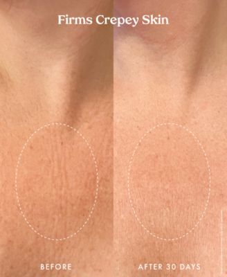 Ultra Renewal Retinol Body Cream, 4.7 oz.