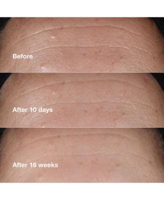 Smart Clinical Repair™ Wrinkle Correcting Serum, 1.7 oz.