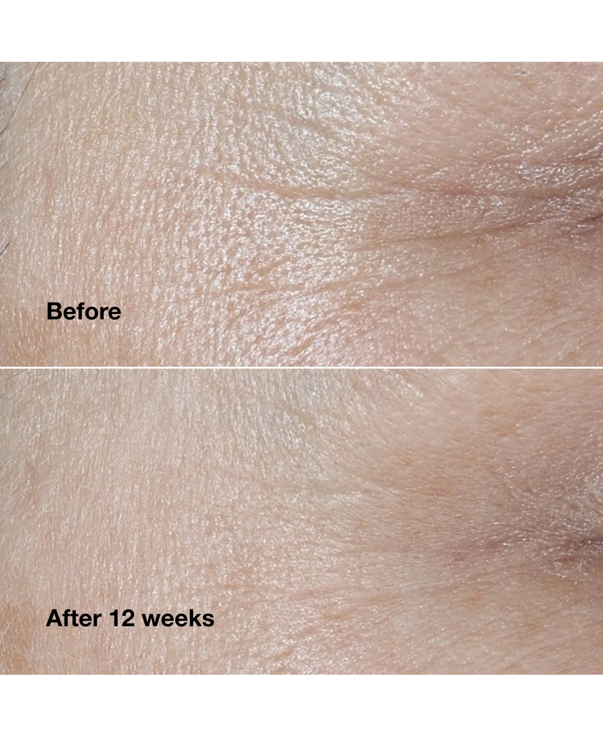 Clinique Smart Clinical Repair Wrinkle Correcting Face Cream
