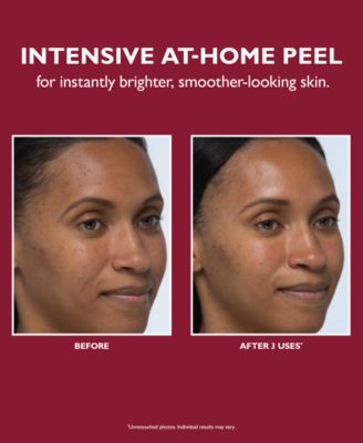 Even Smoother Instant Reveal Facial Peel, 8-Pk.