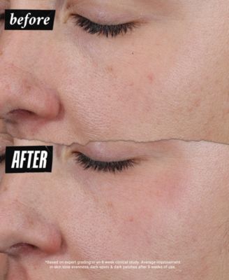 Auto-Tone Discoloration & UV Solution, 1.4 oz.