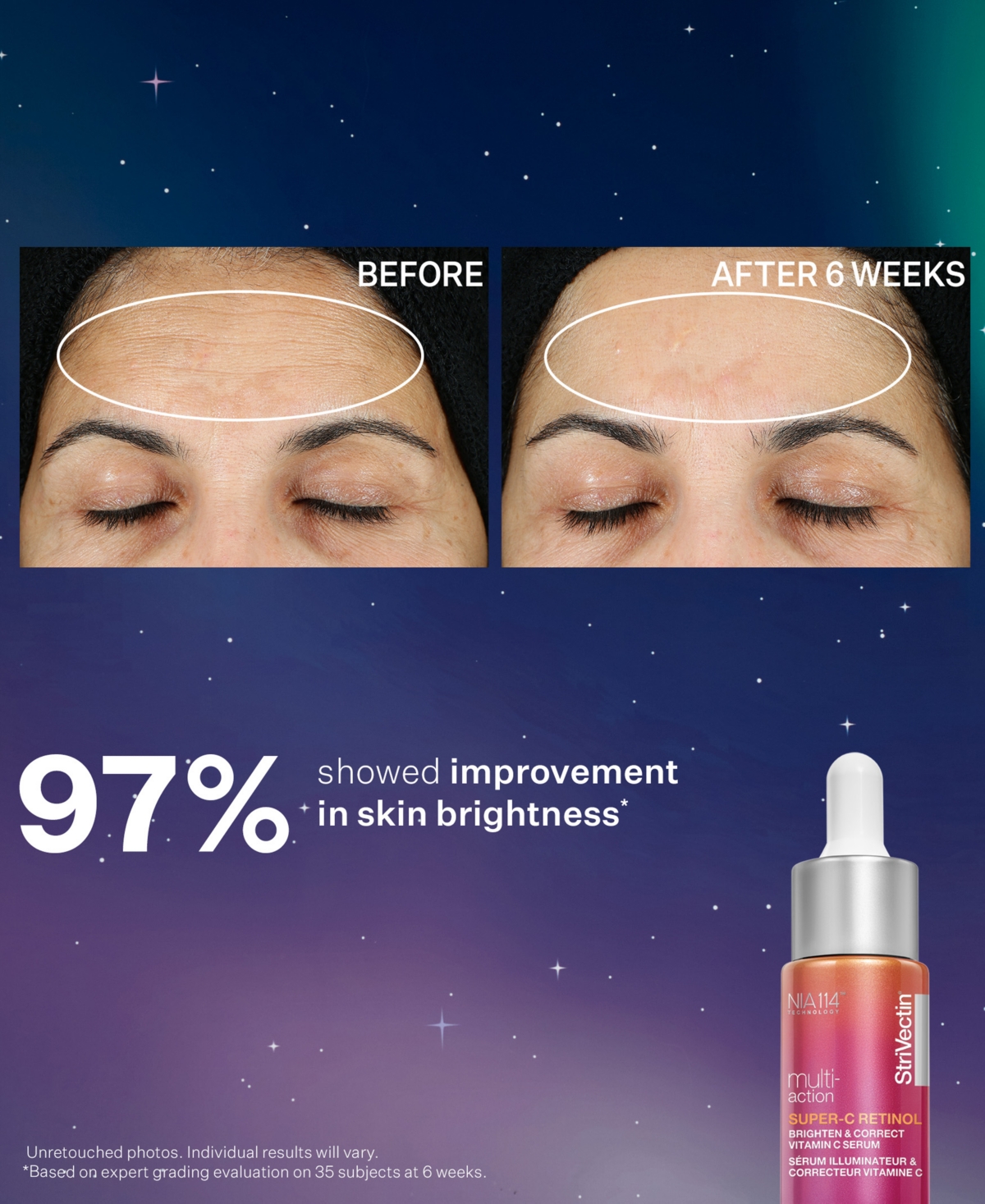 StriVectin 3-Pc. Brighten & Rejuvenate Skincare Set