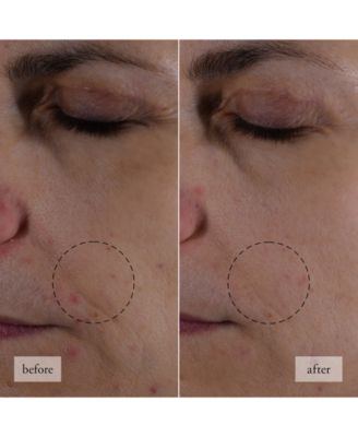 Hope In A Jar Smooth-Glow Multi-Tasking Moisturizer With Pro-Vitamin P, Glycolic & Hyaluronic Acids, 4 oz.