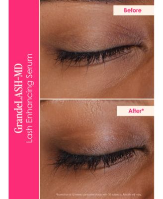 2-Pc. Lash System Set