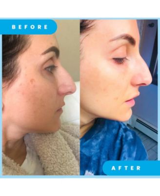 Dark Spot Corrector Remover for Face Ultra Potent Brightening Serum