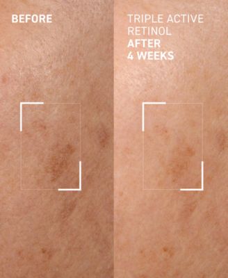 Triple Active Retinol Gentle Overnight Renewal Cream, 1 oz.