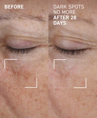 Dark Spots No More Triple Acid Spot Minimizing Concentrate, 0.5 oz.