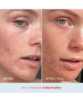 First Aid Beauty Ultra Repair Cream, 6-oz.