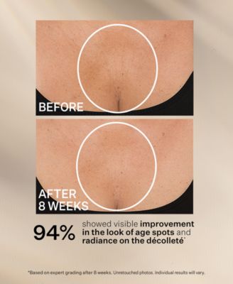 TL Advanced Tightening Neck Cream Plus With Alpha-3 Peptide, 3.4 oz.