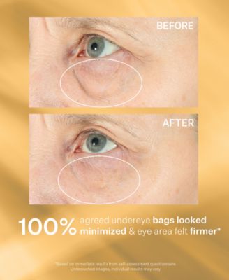 Hyperlift Eye Instant Eye Fix