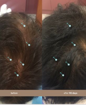 Spectral.DNC-N Hair Density Serum With Nanoxidil 5%, 60 ml