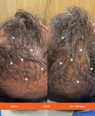 REVITA High-Performance Hair Density Shampoo, 925 ml