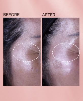 Retinol + HPR Ceramide Capsules Rapid Skin Renewing Serum, 30 capsules