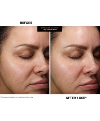 ExfoliKate Cleanser Daily Foaming Wash, 4 oz.