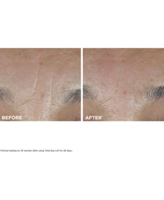 Total Eye Lift Eye Cream Refill for Firming, Wrinkles, Dark Circles & Puffiness, 0.5 oz.