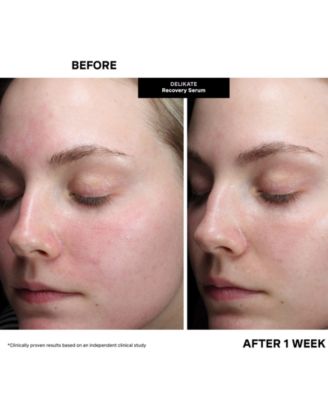 DeliKate Recovery Serum, 1 oz.