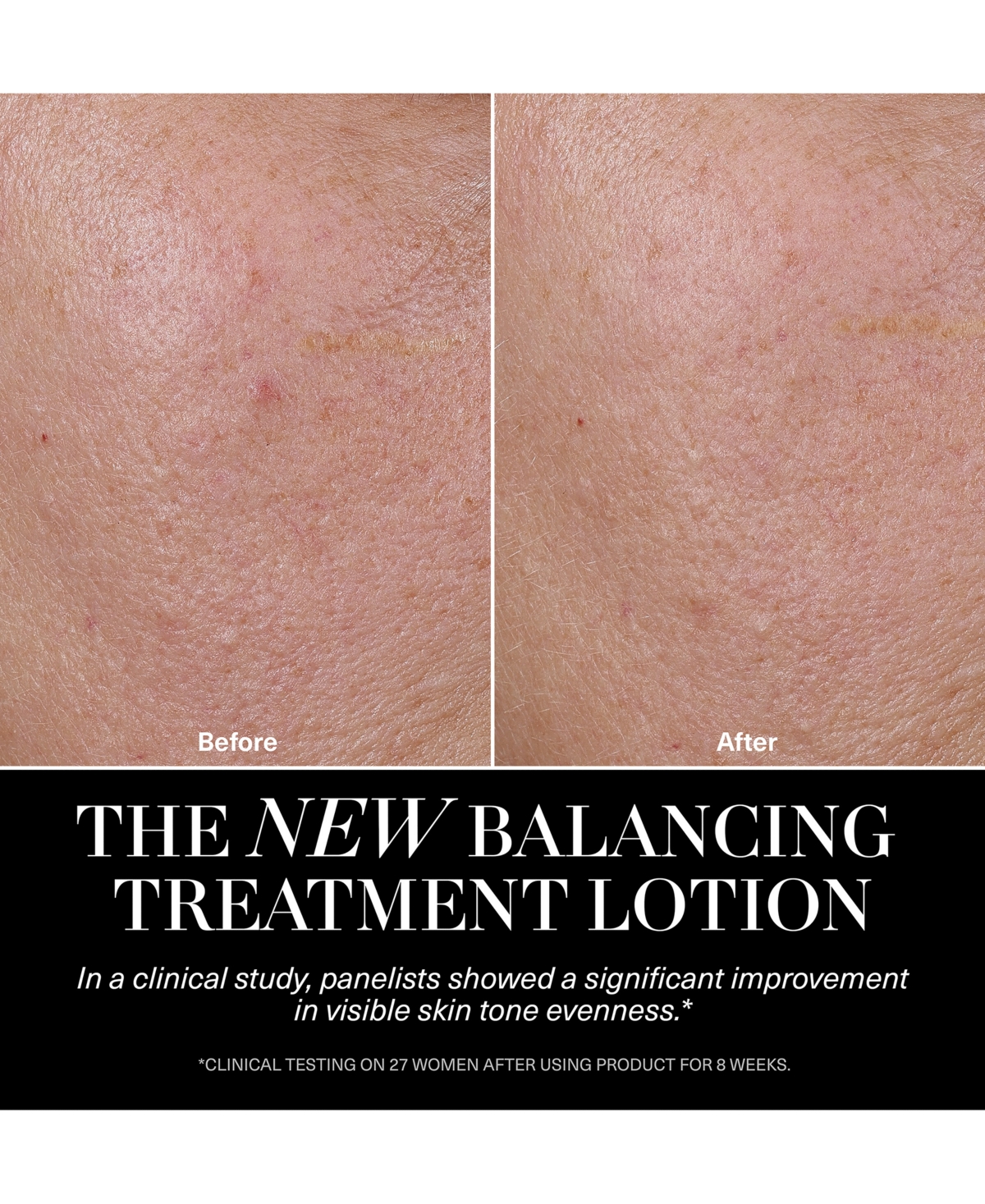 La Mer The Balancing Treatment Lotion 5.1 Oz. In Transparent