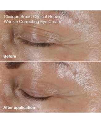 Wrinkle-Fighting Routine Skin Care Gift Set