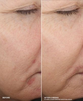 2-Pc. Vitamin Enriched Home and Away Smoothing Serum Set