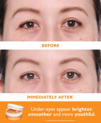 Full-Size Vitamin C & Hyaluronic Eye Patches 2-Piece Kit