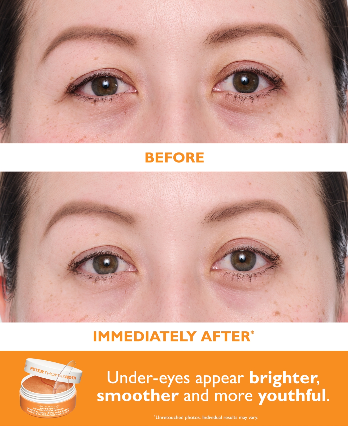 Peter Thomas Roth 2-pc. Vitamin C And Hyaluronic Eye Patches Set In Transparent