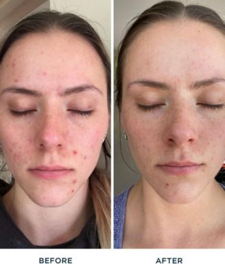 FR&Eacute; Recover Me Restorative Night Cream, 1.69oz.