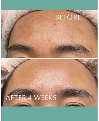 Albion Skin Conditioner Essential N