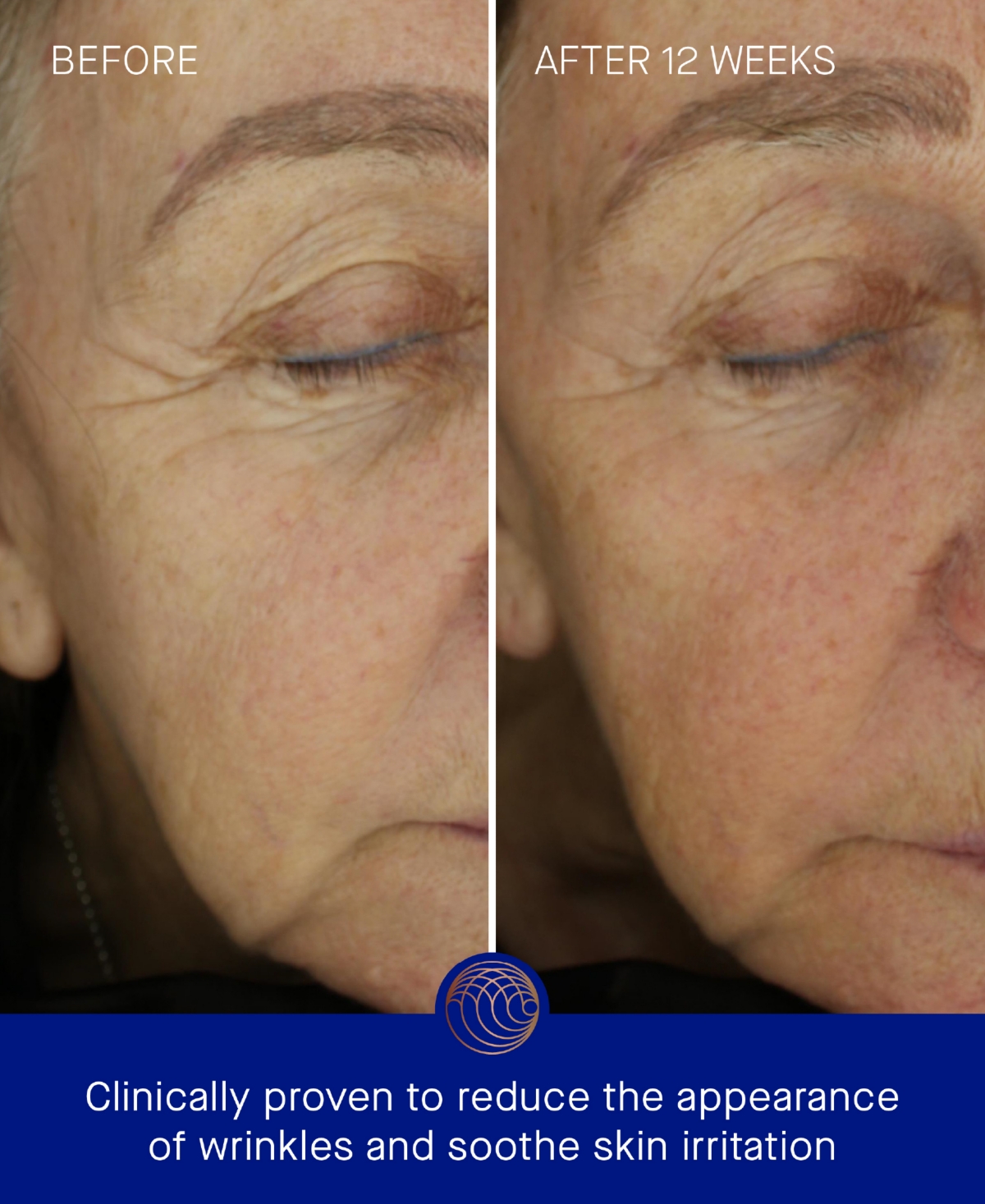 Augustinus Bader The Ultimate Soothing Cream, 1.69 oz.