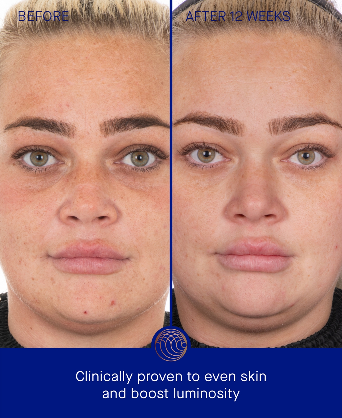 Augustinus Bader The Face Cream Mask, 1.69 oz.