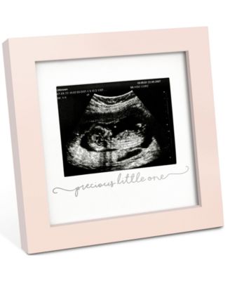 Solo Baby Sonogram Picture Frame, Modern Ultrasound Picture Frames, Pregnancy Announcements Sonogram Frame