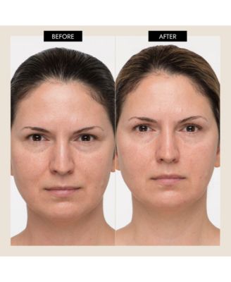 MyoLift Mini Spa Starter Kit