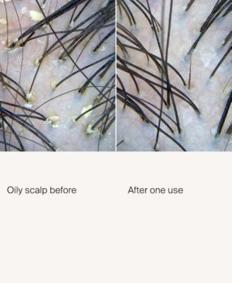 Scalp Care Exfoliator, 3.4 oz.