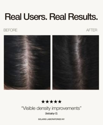 Red LED Light therapy Hair Growth Cap