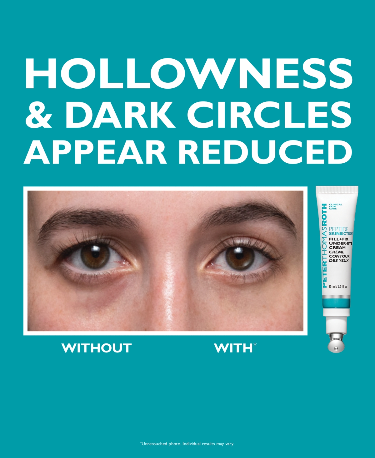 Peter Thomas Roth 2-Pc. Peptide Skinjection Gift Set